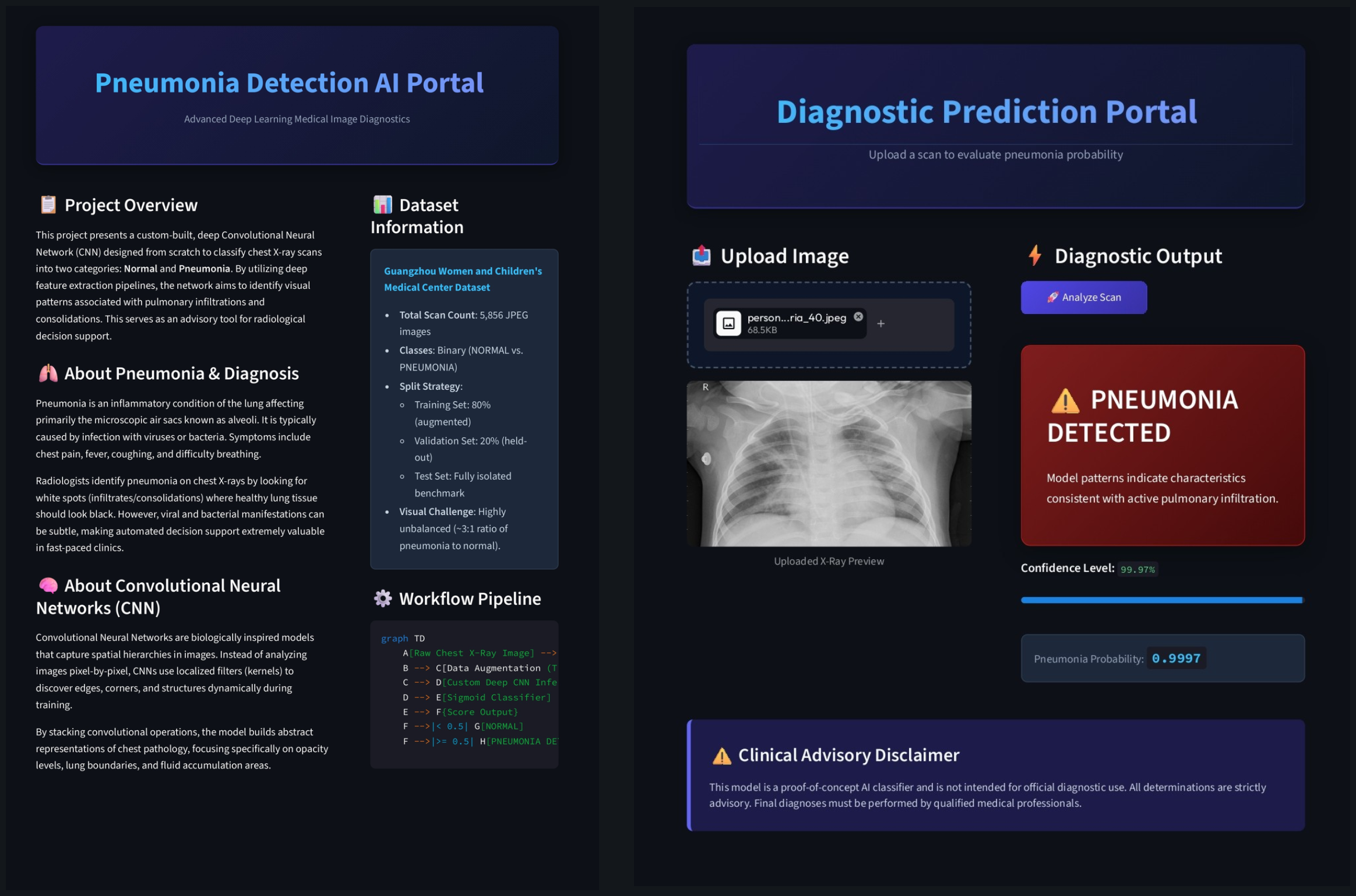 Pneumonia-Detection-CNN